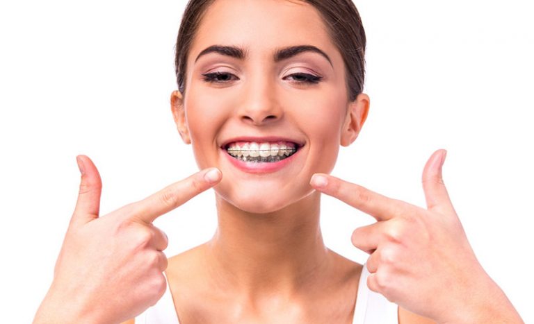 Jaw Alignment Problem? Get Your Braces On - Portland Braces